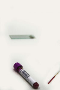 alt=”blood sample” alt=”analize sange”